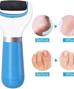 Cordless Electric Callus Remover