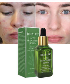 breylee acne treatment serum